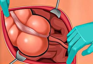 OPERATE NOW: PERICARDIUM SURGERY jogo online gratuito em Minijogos