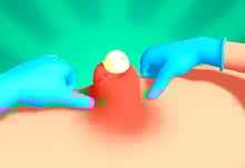 Pimple Squeeze